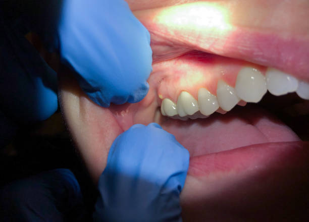 Best Weekend Emergency Dental Services in St Regis Park, KY