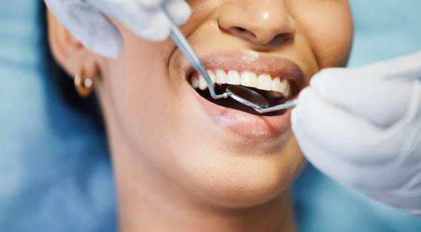 Best Emergency Dental Care for Sports Injuries in St Regis Park, KY