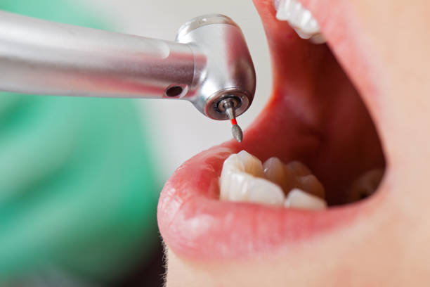 Best Urgent Dental Care for Toothaches in St Regis Park, KY